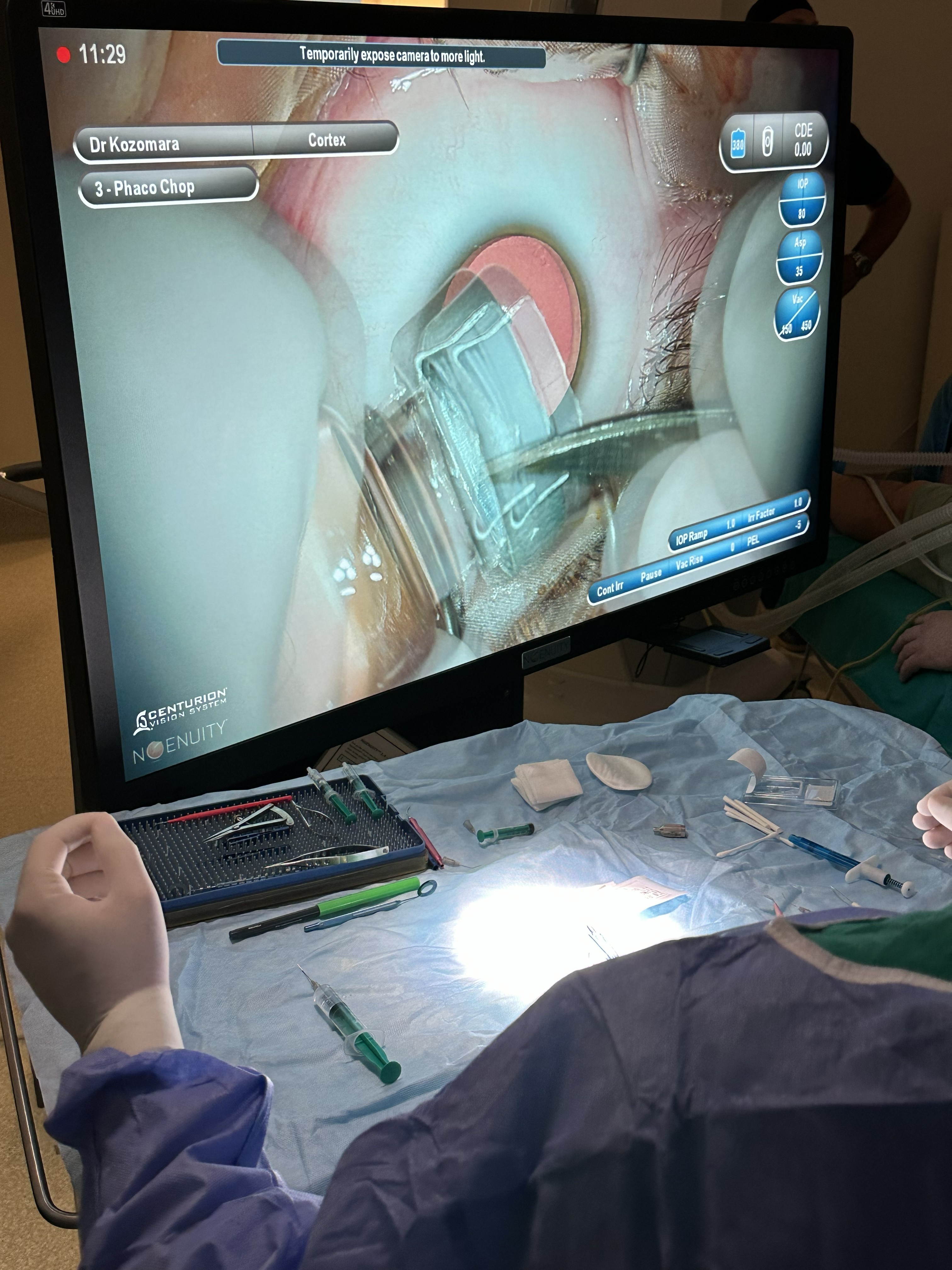 Fakična intraokularna sočiva 